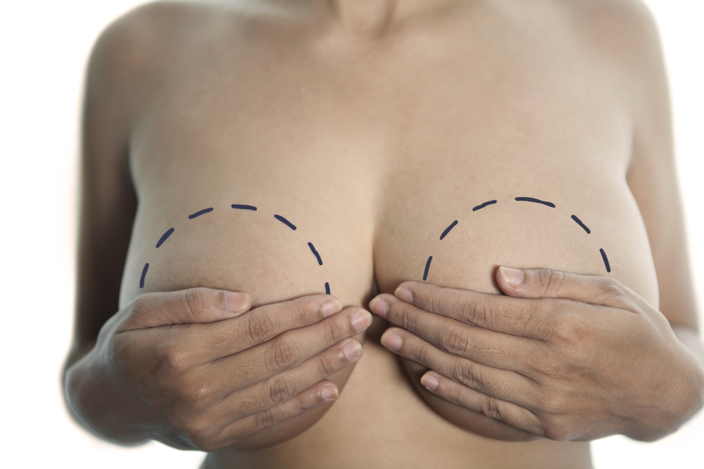 breast-implant-popularity-.jpg